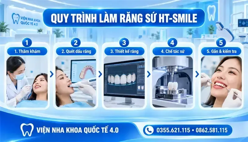 Răng sứ HT-Smile - ảnh 3