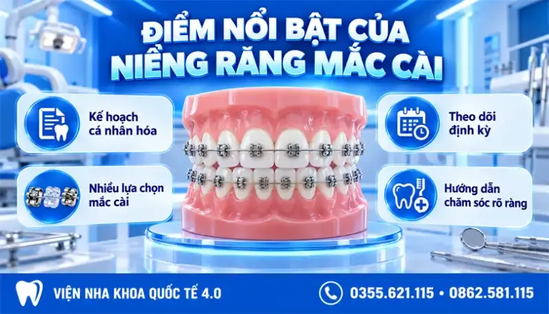Niềng răng mắc cài - ảnh 4