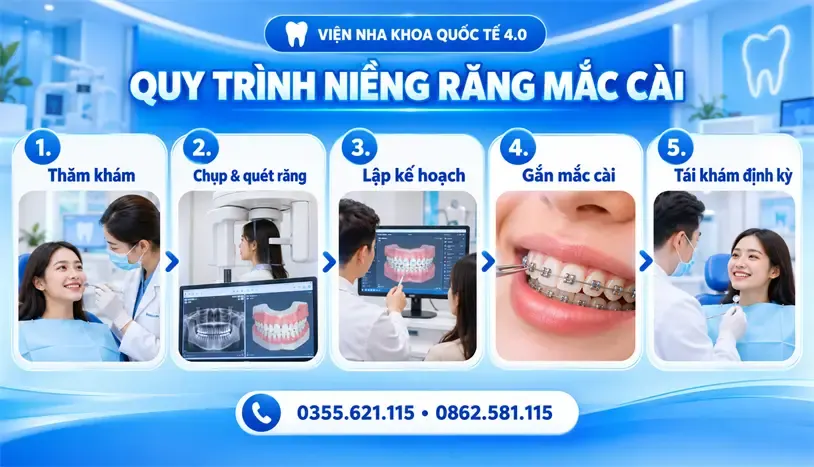Niềng răng mắc cài - ảnh 3