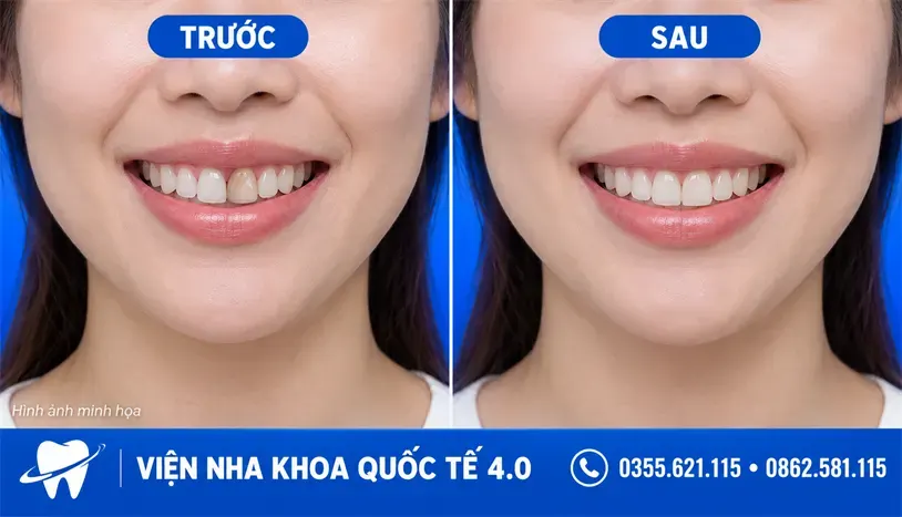 Nội dung nha khoa - ảnh 2